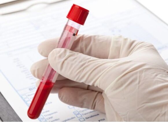 Laborategiko diagnostiko metodoek mikroflora patologikoa edo birusa identifikatzeko aukera ematen dute